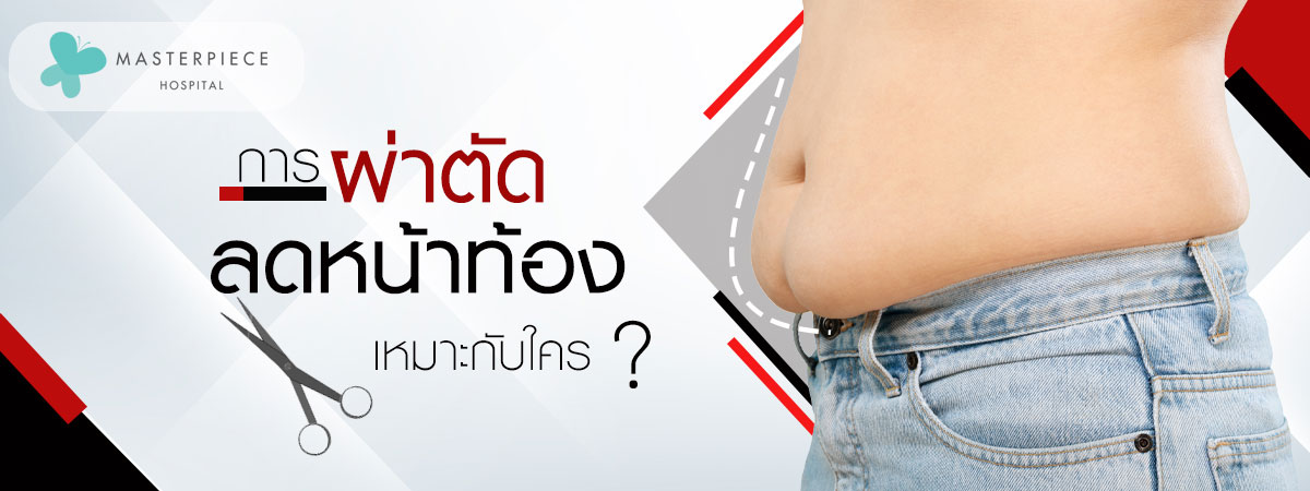 การผ่าตัดลดหน้าท้องเหมาะกับใคร?