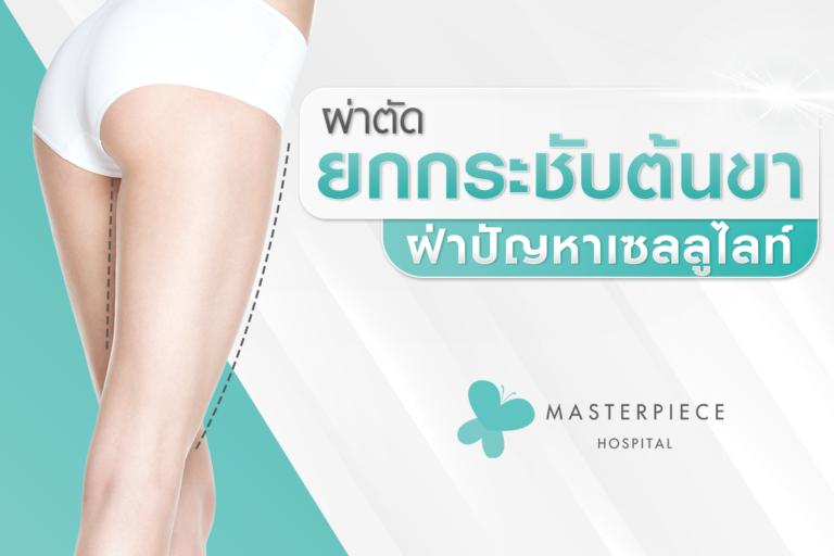 ผ่าตัดยกกระชับต้นขาฝ่าปัญหาเซลลูไลท์
