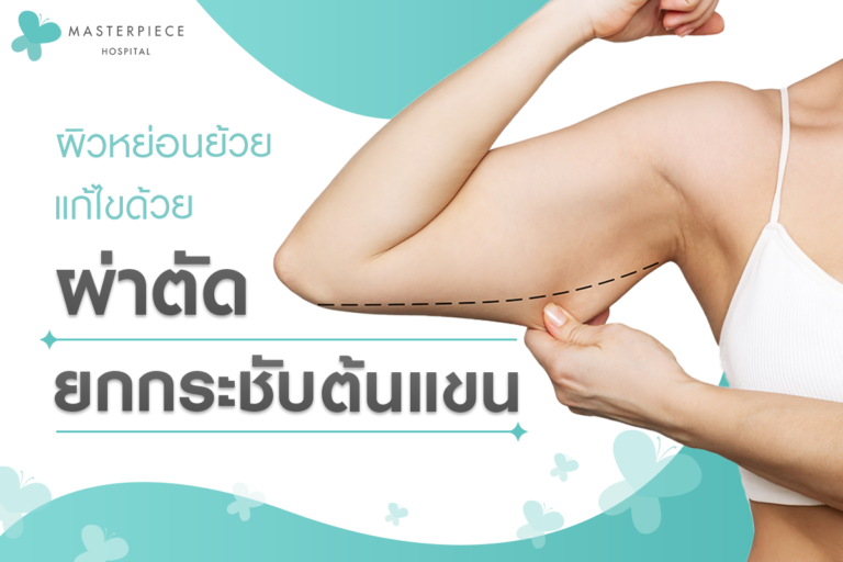 ผิวหย่อนย้วยแก้ด้วยผ่าตัดยกกระชับต้นแขน