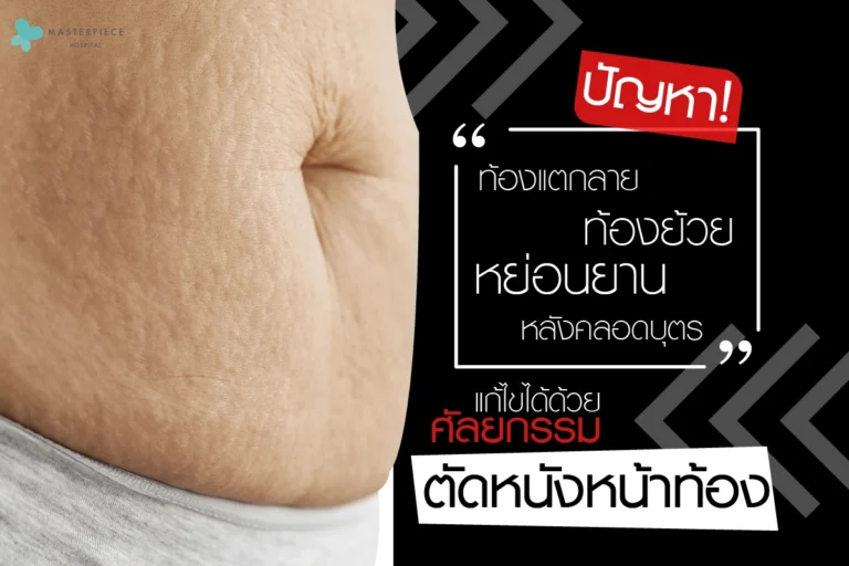 ท้องแตกลาย-ท้องย้วย-หย่อน-ยาน-หลังคลอดบุตร-แก้ไขได้ด้วยศัลยกรรมตัดหนังหน้าท้อง