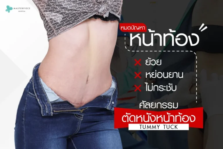 หมดปัญหาหน้าท้องย้วย หย่อนยาน ไม่กระชับด้วย “ตัดหนังหน้าท้อง (Tummy Tuck)”